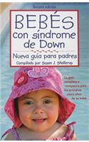 Bebes Con Sindrome de Down