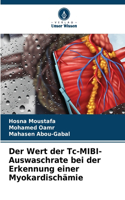 Wert der Tc-MIBI-Auswaschrate bei der Erkennung einer Myokardischämie