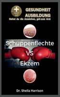 Schuppenflechte (Psoriasis) versus Ekzem
