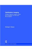 Ophthalmic Imaging