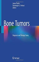 Bone Tumors