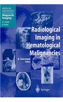 Radiological Imaging in Hematological Malignancies
