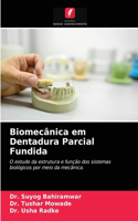 Biomecânica em Dentadura Parcial Fundida