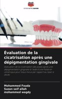 Évaluation de la cicatrisation après une dépigmentation gingivale