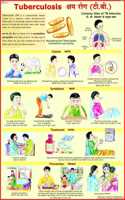 Tuberculosis Chart