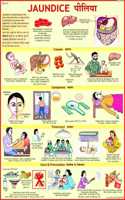 Jaundice Chart